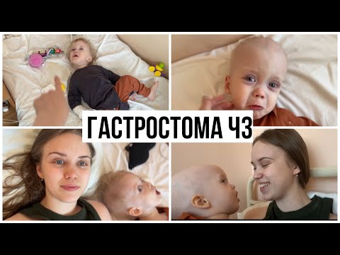 Видео: Лопнула Стома. Реанимация. Брею налысо.