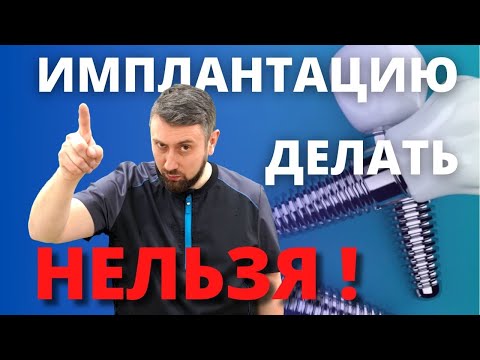 Видео: Противопоказания к  имплантам. Противопоказания к имплантации зубов.