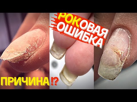 Видео: ГРУБЕЙШАЯ ОШИБКА в маникюре и ее последствия 😳🤯 НЕ ДЕЛАЙТЕ ТАК!