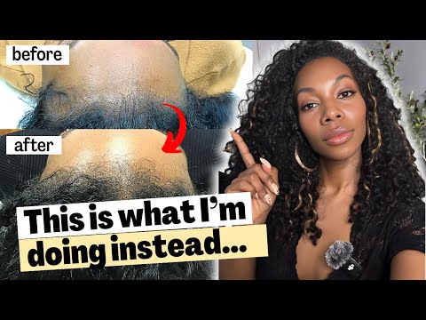 Видео: Почему Nutrafol стоит 90 долларов?! Почему я перестал платить 90 долларов за добавки для роста волос