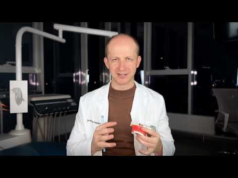 Видео: Скуловая имплантация Зигома / Zygoma