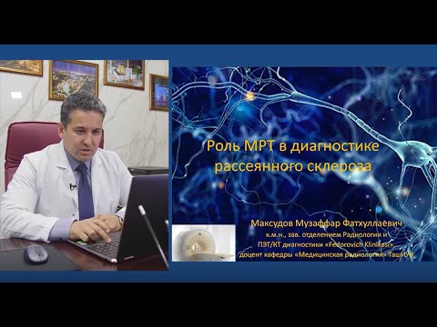 Видео: Роль МРТ в диагностике рассеянного склероза.