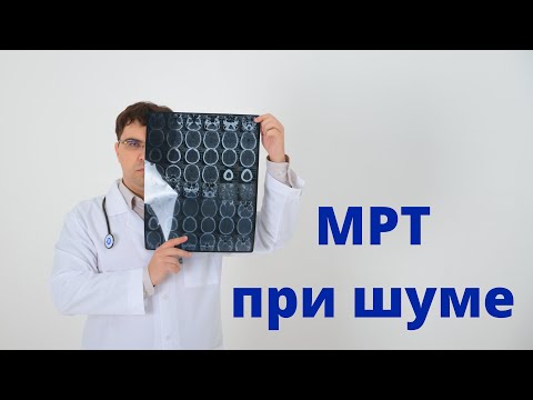 Видео: МРТ при шуме в ушах