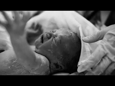 Видео: Видео родов кесарево