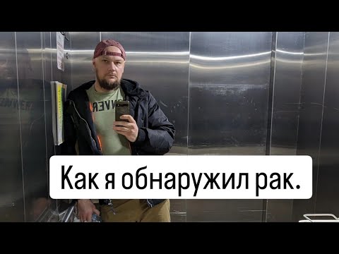 Видео: Рак кишечника. Как выявили диагноз. #онкология #рак #раккишечника #химиотерапия