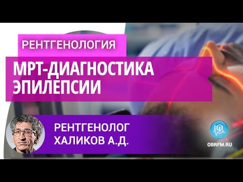 Видео: Рентгенолог Халиков А.Д.: МРТ-диагностика эпилепсии
