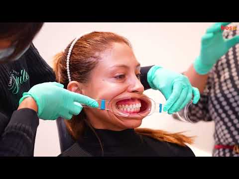 Видео: Ортодонтические записи: как делать ортодонтические фотографии (3 внеротовые и 5 внутриротовых)