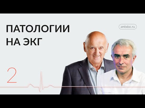 Видео: «В ритме сердца»: перелистаем страницы первой части практикума по ЭКГ. 28.02.24.