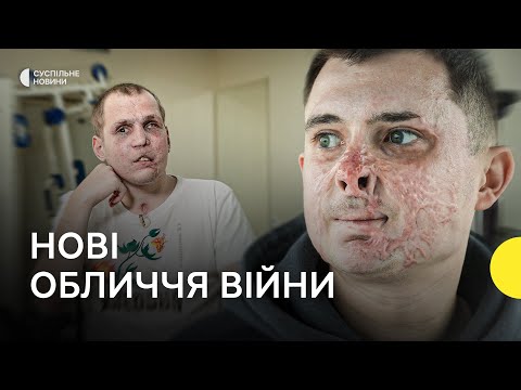 Видео: «Це все ще я» — військові, обличчя яких назавжди змінила війна