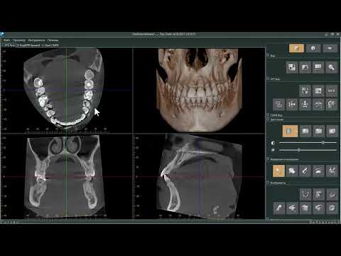 Видео: Простая и понятная видеоинструкция по работе с программой Morita iDixel