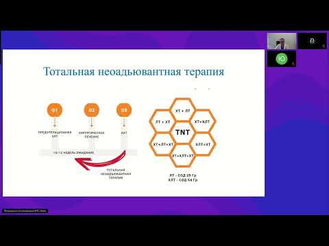 Видео: Опухоли ЖКТ (вебинар 19 мая 2025)