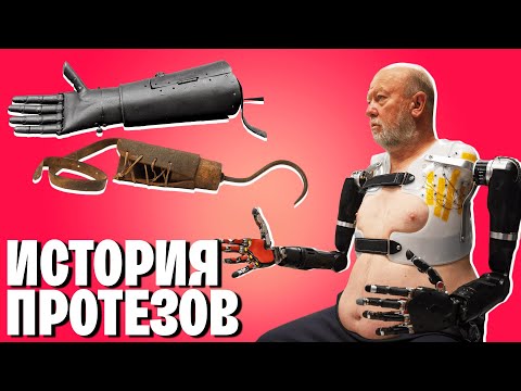 Видео: Современные чудеса медицины: История протезирования, которая удивит даже врачей | WAS