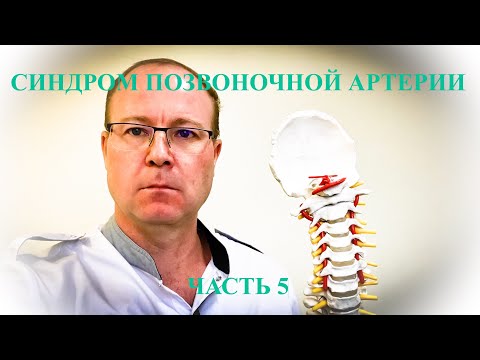 Видео: Синдром позвоночной артерии. Причины, статистика, диагностика, лечение
