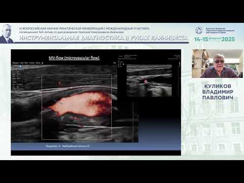 Видео: Новые ультразвуковые методы оценки нестабильности атеросклеротической бляшки