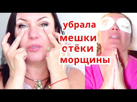 Видео: СИЛЬНАЯ МАСКА от Морщин ВОКРУГ ГЛАЗ! Уйдут Отёки , Круги Малярные Мешки  skincare