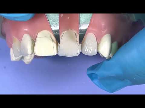 Видео: Протокол финишной обработки реставрации со всеми хитростями и плюшками