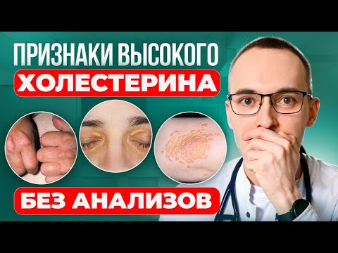 Видео: КАК ВЫЯВИТЬ ПОВЫШЕННЫЙ ХОЛЕСТЕРИН ДОМА БЕЗ ВРАЧЕЙ