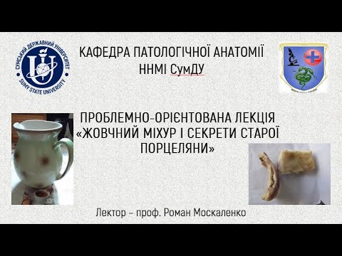 Видео: ПРОБЛЕМНО-ОРІЄНТОВАНА ЛЕКЦІЯ «ЖОВЧНИЙ МІХУР І СЕКРЕТИ СТАРОЇ ПОРЦЕЛЯНИ»