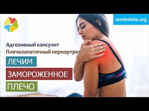 Видео: 💯Рычаг решает! Адгезивный капсулит | Плечелопаточный периартрит как лечить | Упражнения ЛФК