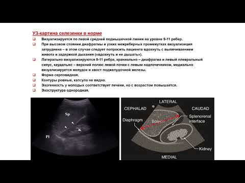 Видео: Ультразвуковая диагностика (УЗИ). Доктор Иогансен. Выпуск 59. Методика УЗИ селезенки.