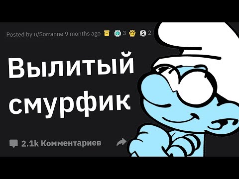 Видео: У Меня АЛЬБИНИЗМ. Задавайте Вопросы