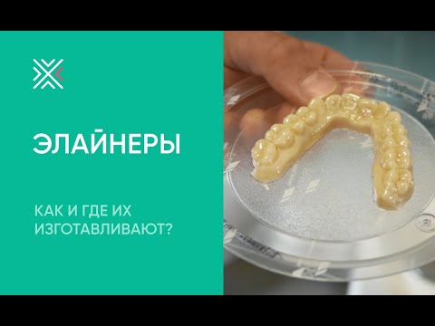 Видео: Элайнеры для выравнивания зубов: как и где их изготавливают?