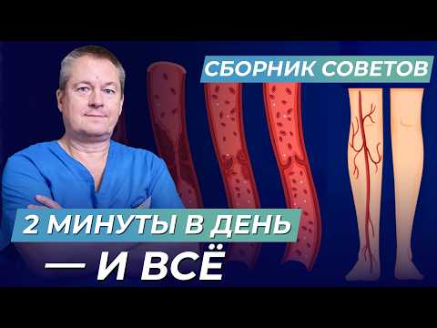 Видео: 99% ВРАЧЕЙ СКРЫВАЮТ причину ВАРИКОЗА! Почему одни страдают, а другие нет?