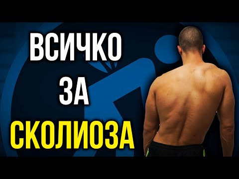 Видео: Изправяне на СКОЛИОЗА. Видове гръбначно изкривяване + УПРАЖНЕНИЯ