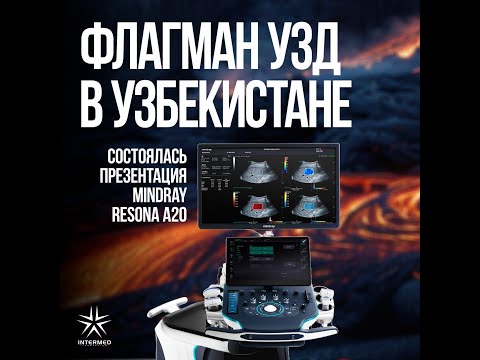 Видео: Как создавали Reasona A20 | Прорыв в мире УЗИ-технологий