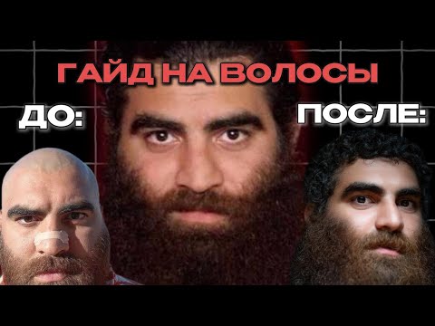 Видео: Красивые и густые волосы: что скрывают от тебя врачи. / Арсен Маркарян про волосы.