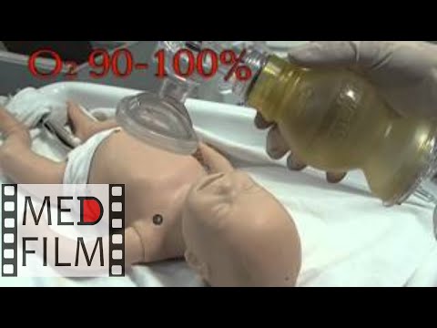Видео: Реанимация новорожденных в родильном зале © Neonatal resuscitation