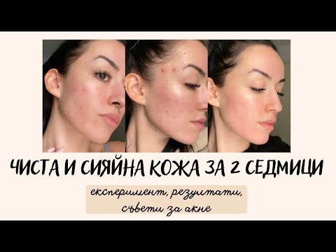 Видео: АКНЕ | Кожата ми стана по-сияйна, пъпките ми изчезнаха | ЦЯЛА РУТИНА, РЕЗУЛТАТИ, СЪВЕТИ