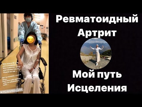 Видео: Дважды встала с инвалидной коляски Ювенильный ревматоидный артрит излечим? Я смогла, значит излечим