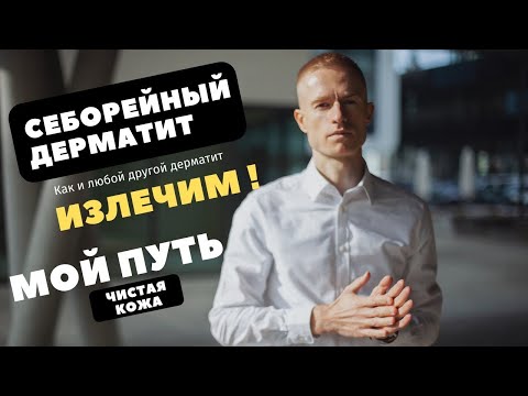 Видео: Себорейный дерматит. Мой путь полного излечения с пошаговой инструкцией! Как избавится от себореи?