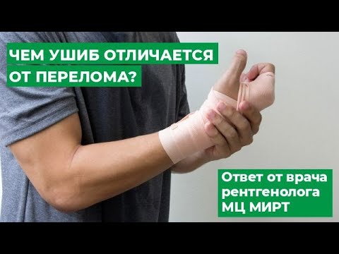 Видео: Чем ушиб отличается от перелома? Ответ от врача рентгенолога МЦ МИРТ