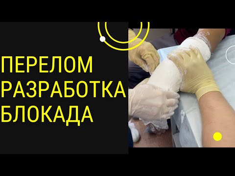 Видео: ПЕРЕЛОМ ЛУЧЕВОЙ КОСТИ| Контрактура| Блокада| Что делать после Снятия ГИПСА| Доктор Юршин