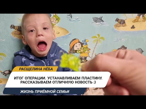 Видео: Об итогах реуранопластики | Установка и уход за пластиной