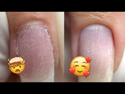 Видео: Маникюр при сильно Налипшей Кутикуле | Быстрый дизайн ногтей