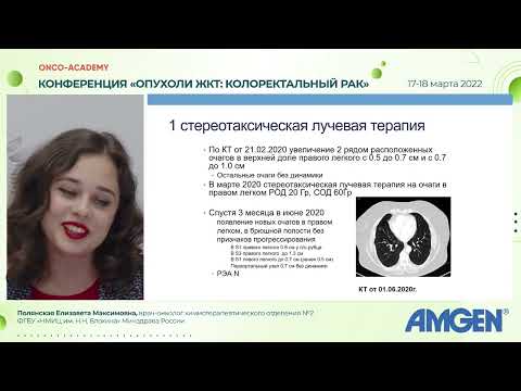 Видео: Клинический случай №1.Опыт длительного лечения метастатического колоректального рака. Полянская Е.М.