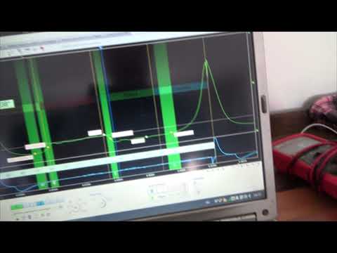 Видео: Лада Приора троит после ремонта. Диагностика мотортестером Диамаг-2
