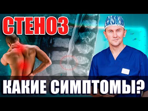Видео: Стеноз| Какие симптомы, что происходит в организме? Нейрохирург