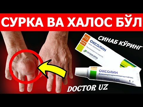 Видео: БУ ХАҚДА АПТЕКАЧИЛАР ИНДАМИДИ ОКСОЛИН МУЖИЗАСИ, СИНАБ КЎРИНГ!