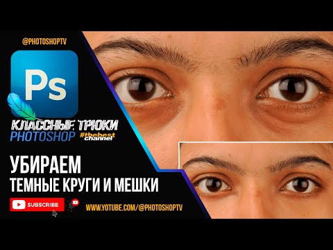 Видео: Простой способ убрать темные круги и мешки под глазами в Фотошопе. Face Retouch | Photoshop TV
