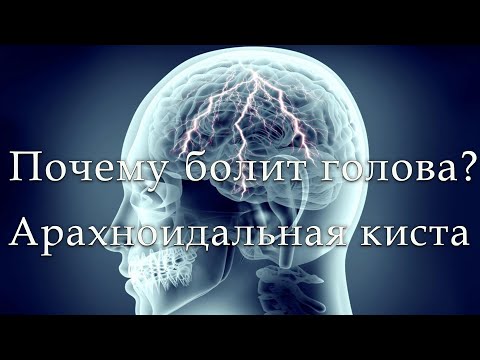 Видео: Что такое арахноидальная или арахноидная киста? Янис Шлезиньш, нейрохирург, Доктор медицинских наук