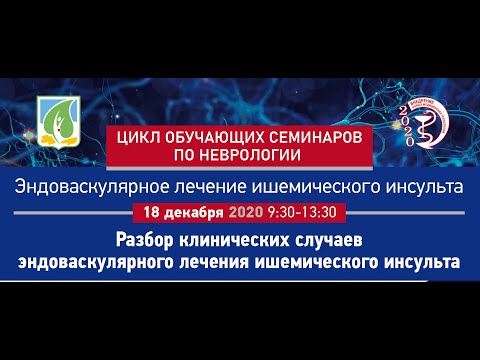 Видео: Семинар «Эндоваскулярное лечение ишемического инсульта. Разбор клинических случаев»