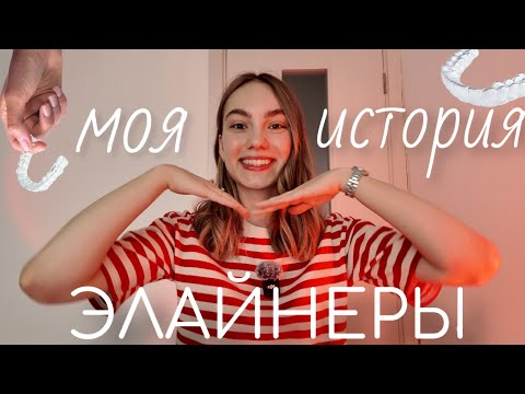 Видео: МОЯ ИСТОРИЯ: ЭЛАЙНЕРЫ | ЭЛАЙНЕРЫ VS БРЕКЕТЫ