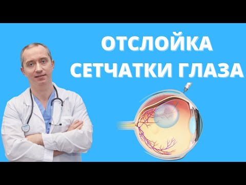 Видео: Отслойка сетчатки глаза. Причины и лечение!