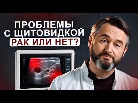 Видео: Врач раскрывает тайны УЗИ щитовидной железы