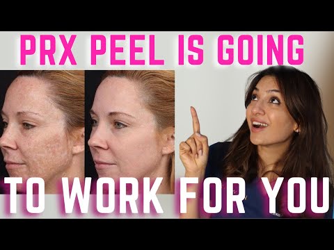 Видео: Пилинг PRX-T33 для подтяжки лица, устранения морщин, пигментации и рубцов