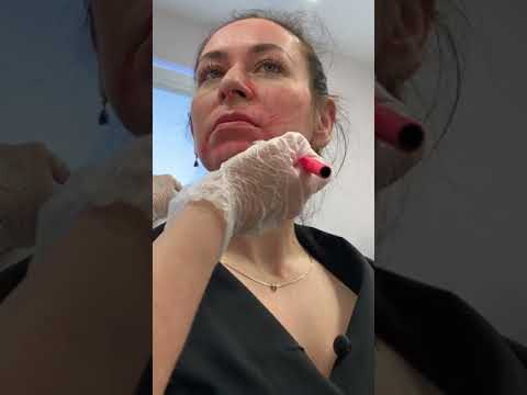 Видео: Платизма